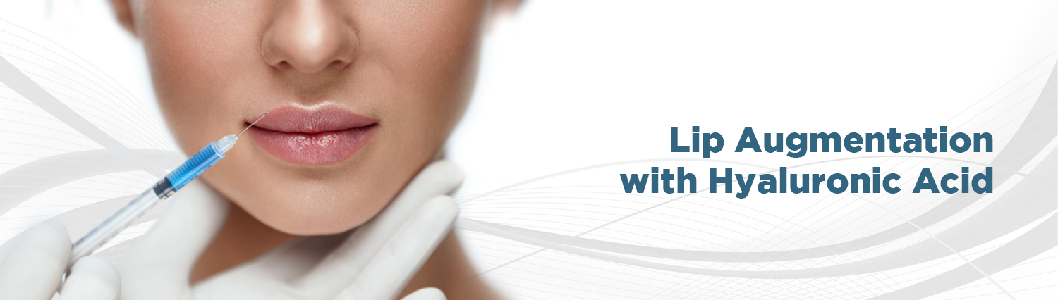 3. Lip Augmentation With Hyaluronic Acid 3. Lip Augmentation With Hyaluronic Acid