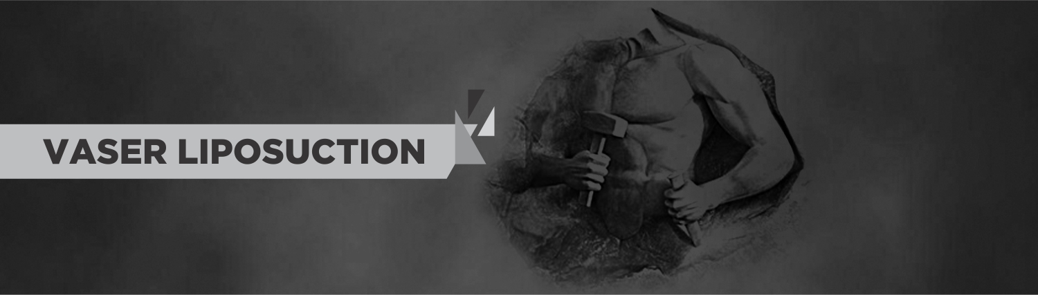 VASER LIPOSUCTION