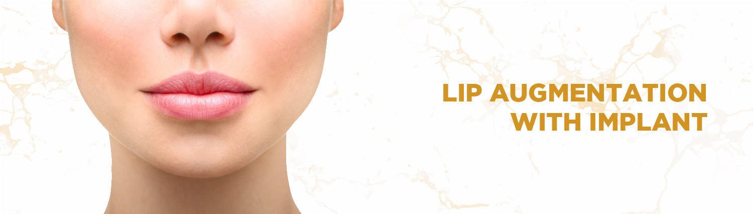 Lip-Augmentation-With-Implant