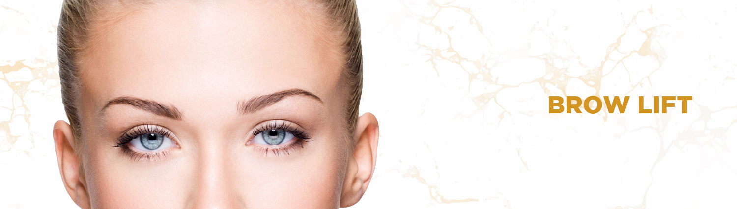 Brow Lift