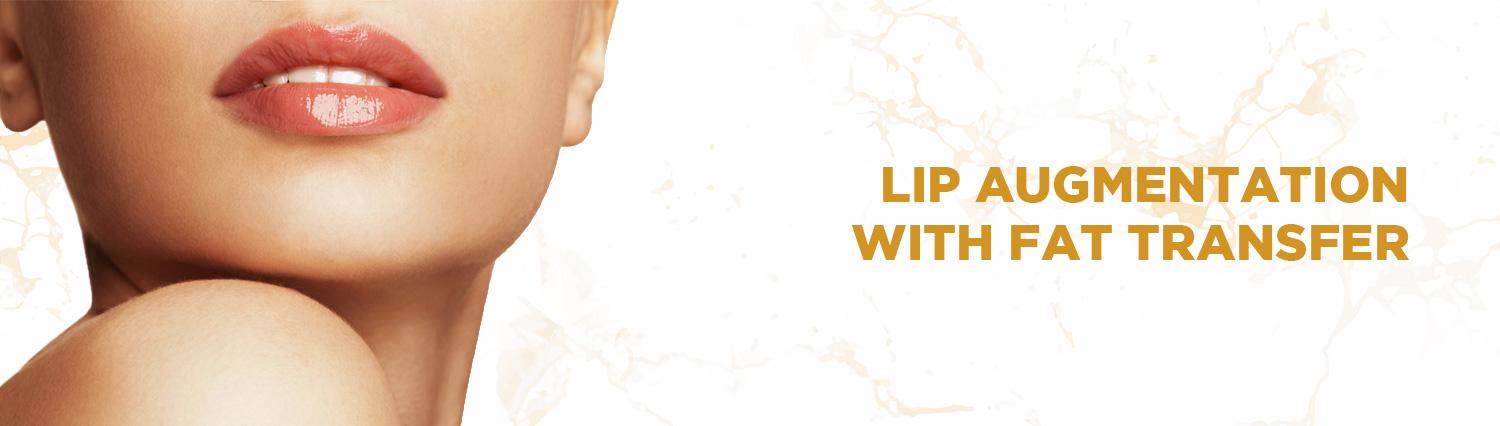 02.-Lip-Augmentation-With-Fat-Transfer