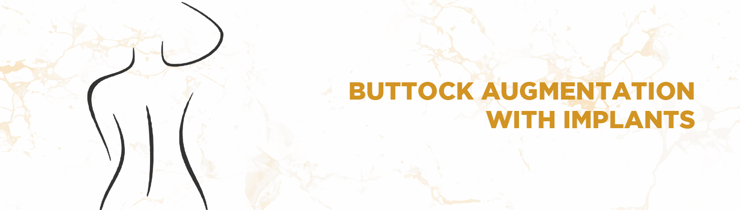 Buttock augmentation with implants