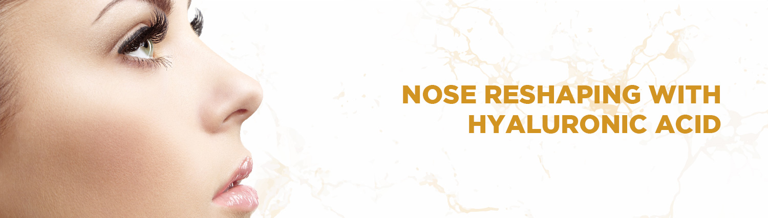 Nose reshaping with hyaluronic acid