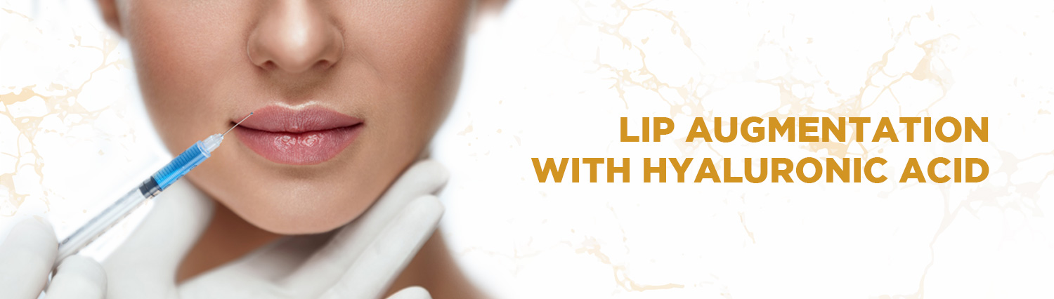 3.-Lip-Augmentation-With-Hyaluronic-Acid 3.-Lip-Augmentation-With-Hyaluronic-Acid